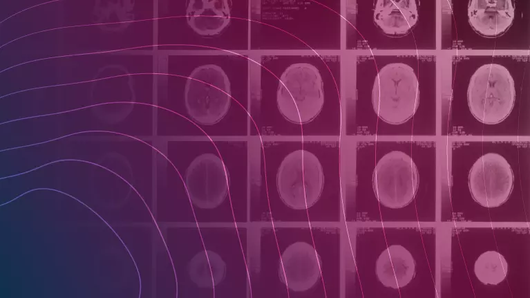 Risk Matters: An analysis of the role of psychiatry in TBI Claims
