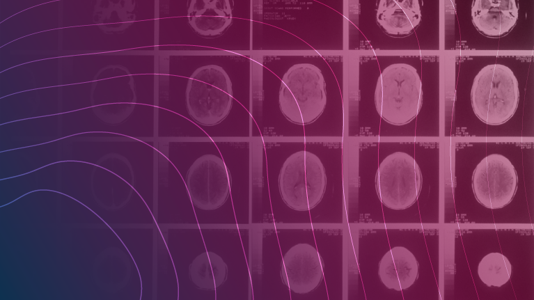 Risk Matters: An analysis of the role of psychiatry in TBI Claims